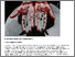 [thumbnail of Full Text]